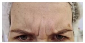До